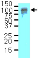 MAB2041 - Amyloid beta A4 protein / APP
