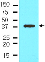 MAB2042 - NANOG