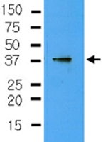 MAB2043 - CYR61