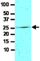 MAB2044 - FADD