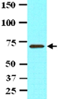 MAB2045 - Protein phosphatase 1G / PPM1G