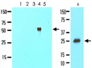 MAB2047 - Cathepsin L1
