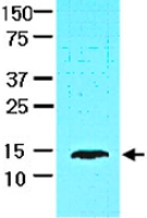 MAB2050 - FABP1