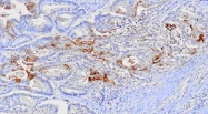 MAB2050 - FABP1
