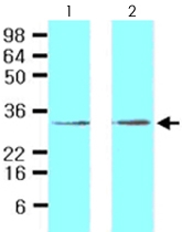 MAB2051 - STEAP / STEAP1