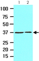 MAB2052 - Laforin