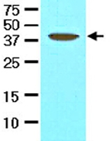 MAB2053 - AVEN