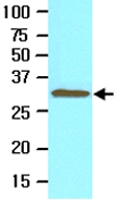 MAB2057 - TOLLIP