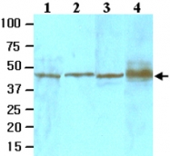 MAB2058 - TGFBI / BIGH3