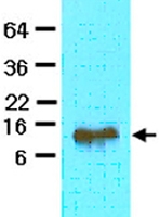 MAB2059 - FABP4
