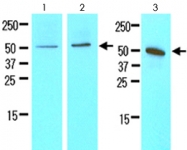 MAB2060 - Chromogranin A