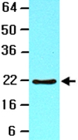 MAB2062 - BID