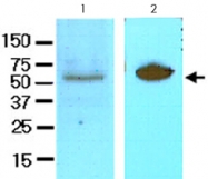 MAB2064 - DACT3