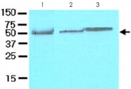 MAB2065 - CFLAR / Casper / I-FLICE