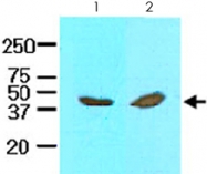 MAB2067 - Interleukin-12 beta / IL12B
