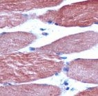 MAB2075 - alpha skeletal muscle Actin / ACTA1