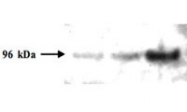 MAB2089 - PMS2
