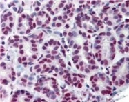 MAB2097 - STAT5 / STAT5A