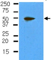 MAB2099 - Podoplanin