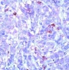 MAB2103 - Phosphotyrosine