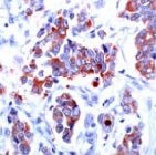 MAB2110 - CD227 / Mucin-1 / MUC1