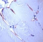 MAB2112 - Dystrophin / DMD