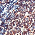 MAB2119 - CD74