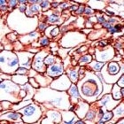 MAB2120 - CD44