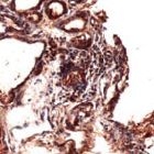 MAB2121 - Thyroglobulin