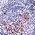 MAB2122 - IGKC
