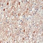 MAB2123 - GFAP