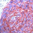 MAB2125 - GLUT1 / SLC2A1