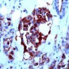MAB2126 - CD227 / Mucin-1 / MUC1
