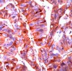 MAB2127 - CD324 / Cadherin-1