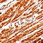 MAB2133 - ACTA2 / aortic smooth muscle Actin