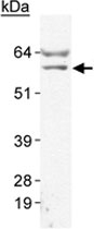 MAB2289 - WT1 / Wilms tumor protein