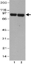 MAB2290 - Thimet oligopeptidase (THOP1)
