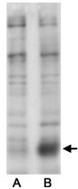 MAB2293 - SLC9A3 / NHE3