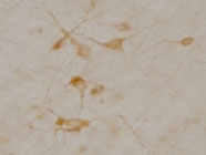 MAB2295 - SLC5A7 / CHT1