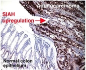 MAB2298 - SIAH2