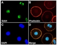 MAB2298 - SIAH2