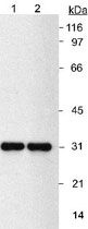 MAB2302 - NQO1