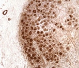 MAB2306 - Neurofibromin
