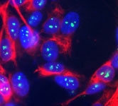 MAB2309 - FBL