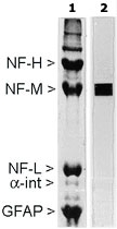 MAB2310 - Neurofilament M (160 kD)