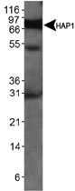 MAB2312 - HAP1
