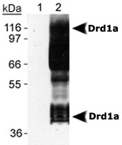 MAB2314 - Dopamine D1 receptor
