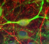 MAB2316 - Alpha-Internexin