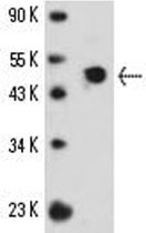 MAB2318 - S-arrestin / SAG