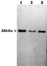 MAB2319 - GAPDH